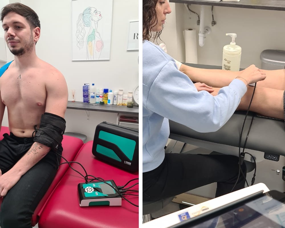 ¿Cómo tratar un desgarro muscular? 4 Cómo tratar un desgarro muscular