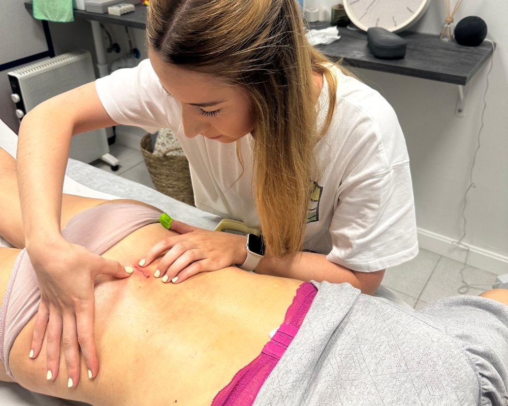 Fisioterapia postquirúrgica 1 Tratamiento propiopcención quirúrgica