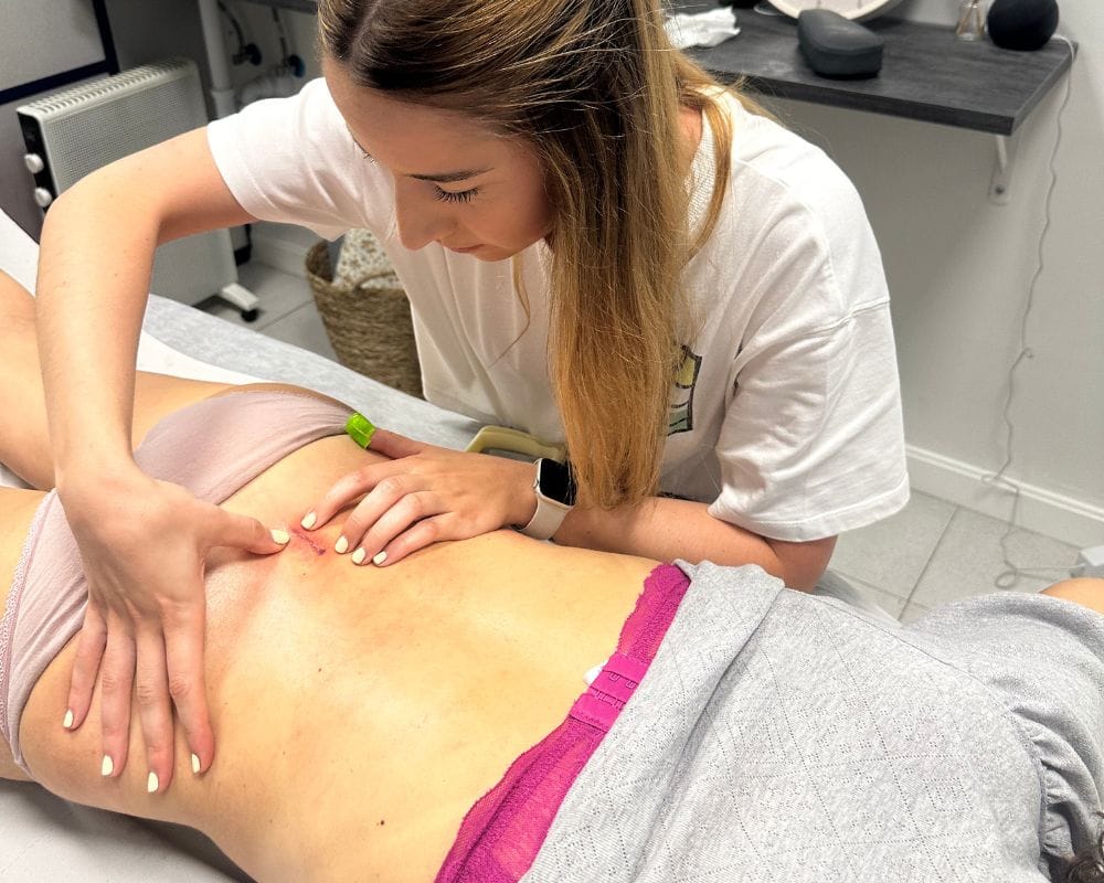 Fisioterapia para cicatrices