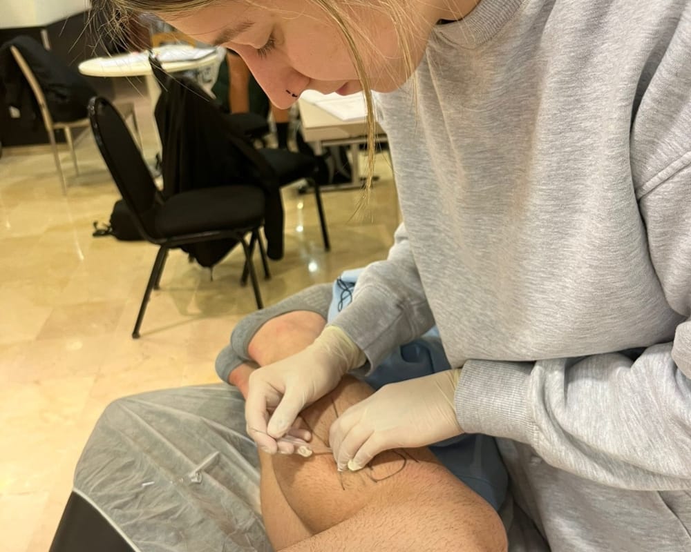 Punción seca para el dolor muscular