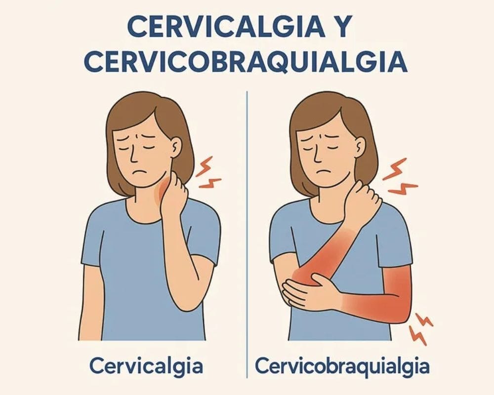 Cervicalgia y cervicobraquialgia